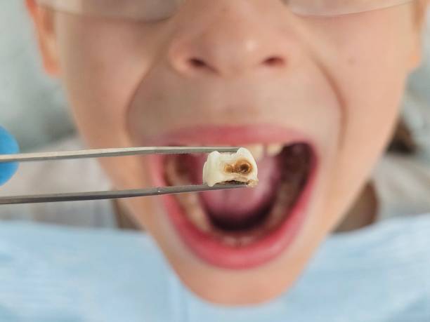 Best Pediatric Emergency Dentist in Glen Cove, NY